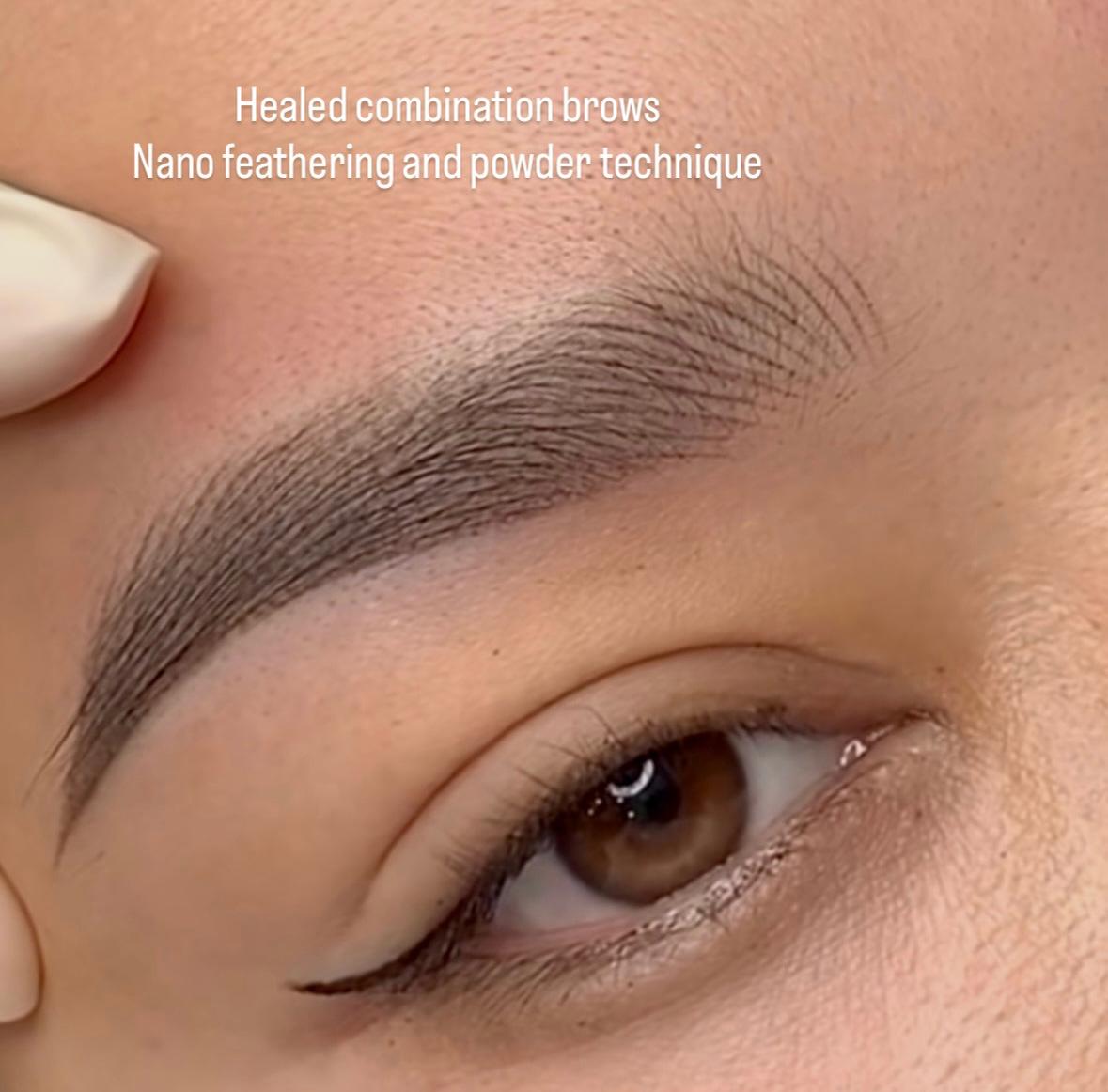 Combination before and after at Glowtique Brisbane